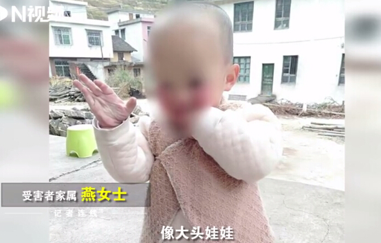 湖南“大頭娃娃”事件